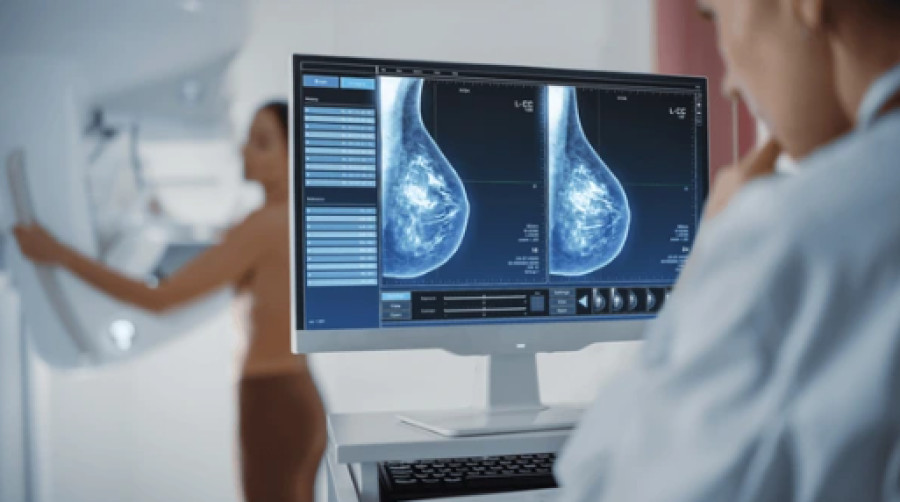 Цифровая маммография: Сила ранней диагностики